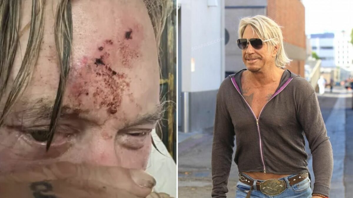 Mickey Rourke Motorcycle Accident: Unravelling the Mystery of What Befell the Actor and Former Boxer