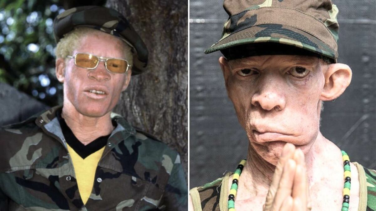What happened to Yellowman face?