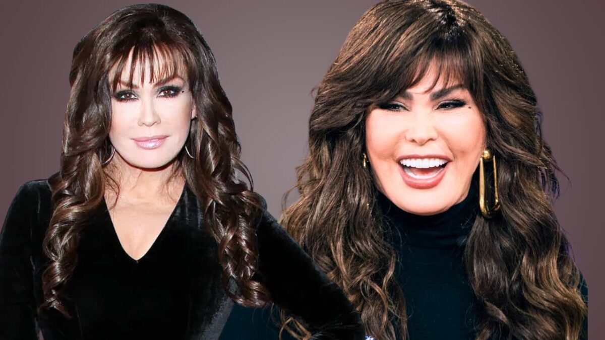 What Happened To Marie Osmond Face