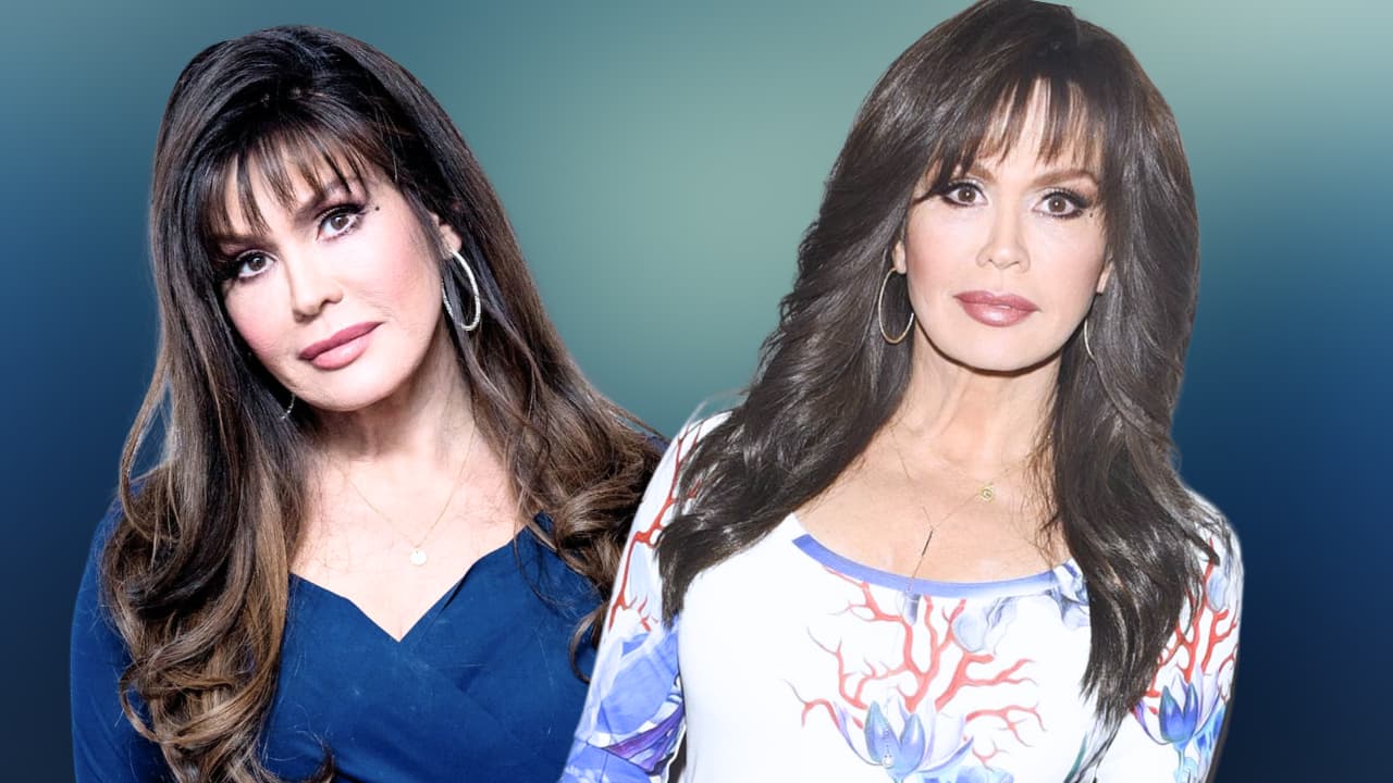 Marie Osmond's path with plastic surgery reveals the intersection of personal preferences, changing beauty standards, and honesty.