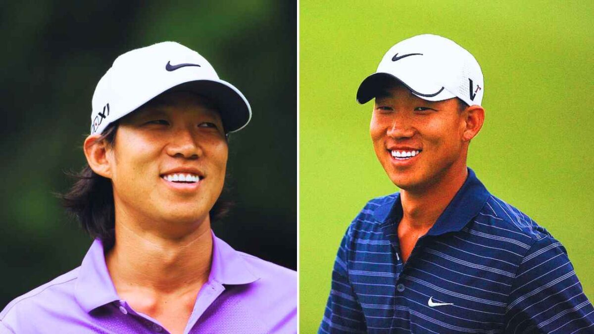 What happened to Anthony Kim's face